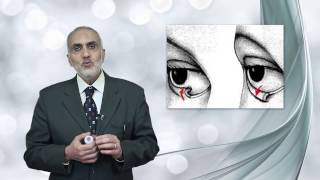 Elbromboly Basic ophthalmology IC Eyelid Disorders of eyelid position [upl. by Betti851]